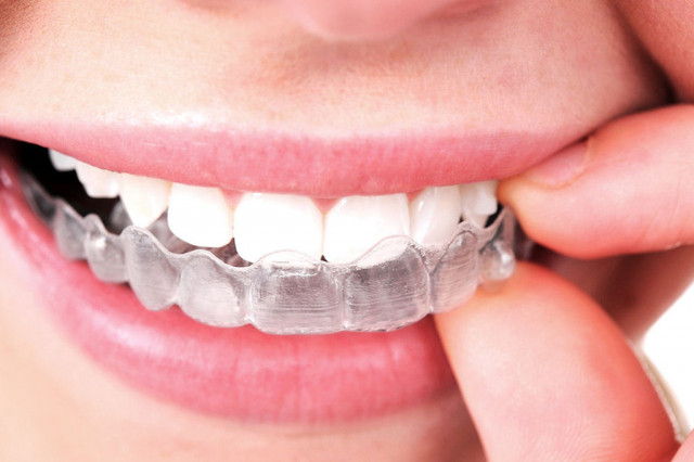 Celina Dentistry in Texas| Cosmetic Dentistry | Dental Implants | Prosper TX Orthodontist