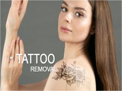 Permanent Tattoo Removal in Kolkata